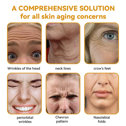 EQVP® 𝘽𝙀𝙀 𝙑𝙀𝙉𝙊𝙈 𝑺𝒌𝒊𝒏 𝑹𝒆𝒔𝒕𝒐𝒓𝒂𝒕𝒊𝒐𝒏 𝑪𝒓𝒆𝒂𝒎 –🌵 Anti-aging,Hydrating, Skin Repair, Even Tone, Acne and Dark Spot Treatment, Wart and Mole Removal, Psoriasis Relief