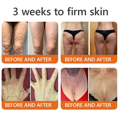 EQVP® 𝘽𝙀𝙀 𝙑𝙀𝙉𝙊𝙈 𝑺𝒌𝒊𝒏 𝑹𝒆𝒔𝒕𝒐𝒓𝒂𝒕𝒊𝒐𝒏 𝑪𝒓𝒆𝒂𝒎 –🌵 Anti-aging,Hydrating, Skin Repair, Even Tone, Acne and Dark Spot Treatment, Wart and Mole Removal, Psoriasis Relief