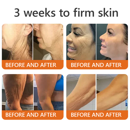 EQVP® 𝘽𝙀𝙀 𝙑𝙀𝙉𝙊𝙈 𝑺𝒌𝒊𝒏 𝑹𝒆𝒔𝒕𝒐𝒓𝒂𝒕𝒊𝒐𝒏 𝑪𝒓𝒆𝒂𝒎 –🌵 Anti-aging,Hydrating, Skin Repair, Even Tone, Acne and Dark Spot Treatment, Wart and Mole Removal, Psoriasis Relief